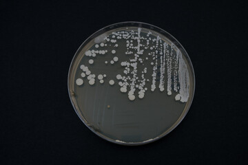 photo of growth of bacterial colonies on nutrient agar