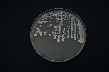 photo of growth of bacterial colonies on nutrient agar - obrazy, fototapety, plakaty