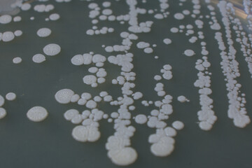closeup photo of growth of bacteria clolonies on agar media