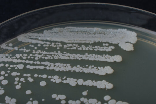 closeup photo of growth of bacteria clolonies on agar media