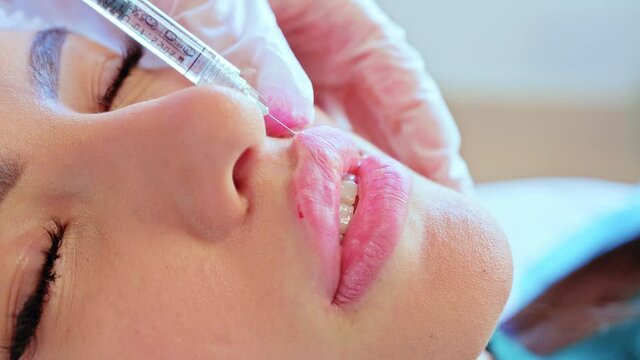Lip augmentation procedure. Beauty injections