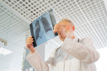 the doctor holds an X-ray of the lungs