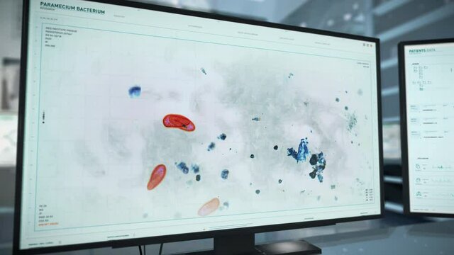 Inspecting the paramecium organic cells under the microscope. Examining the paramecium organic cell biological structure. Analyzing the paramecium organic cell organism composition. Biology Research.