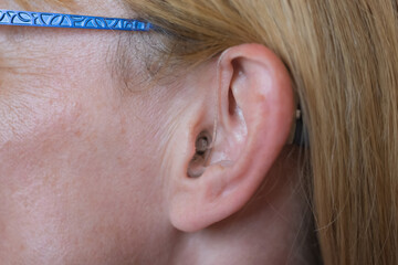 hearing device acoustics in ear of a woman close up detail