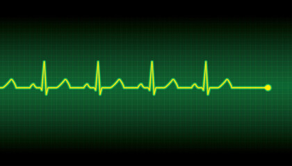 Vector illustration of a heart pulse - 464523267