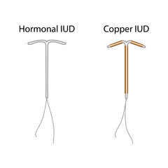 Intrauterine devices. Contraception methods. Vector medical illustration.