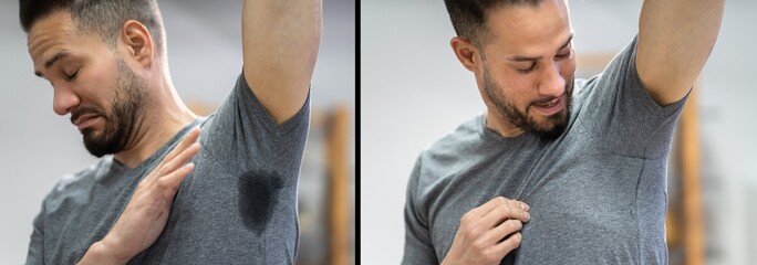 Man With Hyperhidrosis Sweating