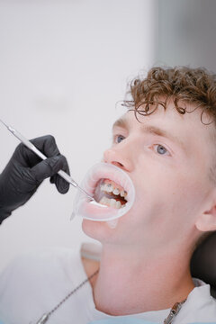 Young guy with curly hair gets braces on his teeth