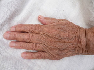 Skin changes in old age