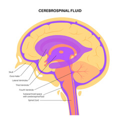 Ventricular system concept