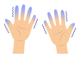 Fototapeta premium 指先の痺れと冷え