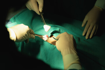 Close-up Hands of Two surgeons working while holding cotton wool piece in forceps and scalpel intentionally in an operating room, Surgery on patient that requires knowledge and Experience.