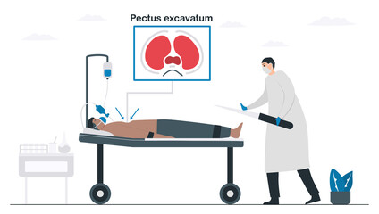 Doctors are operating a patient that is pectus excavatum. Pulmonology vector illustration about restrictive lung disease. Minimal design.