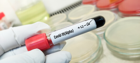 Alpha variant COVID-19 negative, blood sample tube negative with alpha variant or United Kingdom strain COVID-19