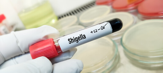 Blood sample tube for Shigella test, Shigella infection or shigellosis