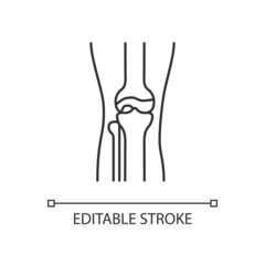 Osteoarthritis linear icon. Cartilage inflammation. Degenerative joint disease. Pain in knee. Thin line customizable illustration. Contour symbol. Vector isolated outline drawing. Editable stroke