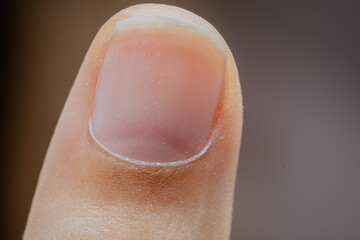 Women's fingernails health.close up