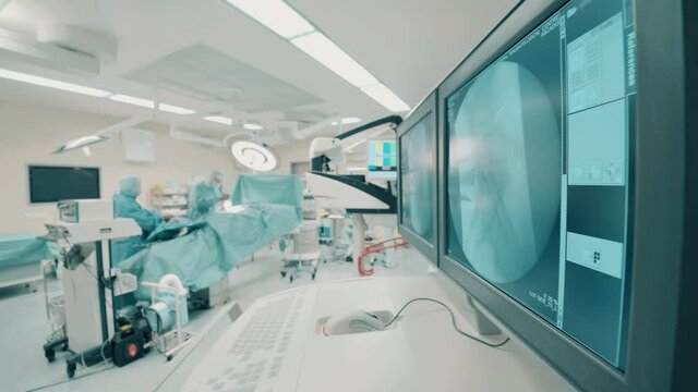 Operating room with scans and a group of doctors doing a surgery