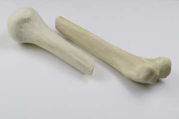 Surgical treatment of bone fractures in orthopedic surgery