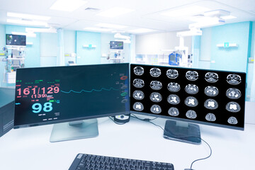 Motion blur in the emergency room hospital, a monitor showing Vital signs, and MRI brain scan , Medical healthcare concept.