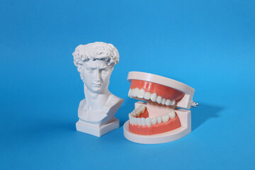 Plaster bust of David with jaw model on bright blue background.