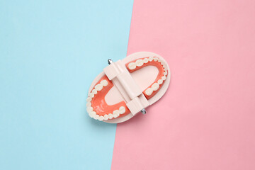 Open Model of human jaw with white teeth on pink blue pastel background. Creative flat lay. Minimal