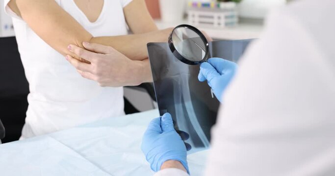 Doctor traumatologist holding xray of elbow joint and magnifying glass in front of sick woman patient 4k movie
