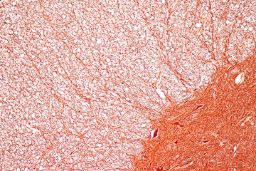 Cerebellum, Thalamus, Medulla oblongata, Spinal cord and Motor Neuron human under the microscope in...