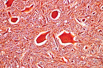 Cerebellum, Thalamus, Medulla oblongata, Spinal cord and Motor Neuron human under the microscope in Lab.
