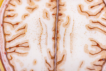 Cerebellum, Thalamus, Medulla oblongata, Spinal cord and Motor Neuron human under the microscope in...