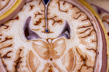 Cerebellum, Thalamus, Medulla oblongata, Spinal cord and Motor Neuron human under the microscope in...