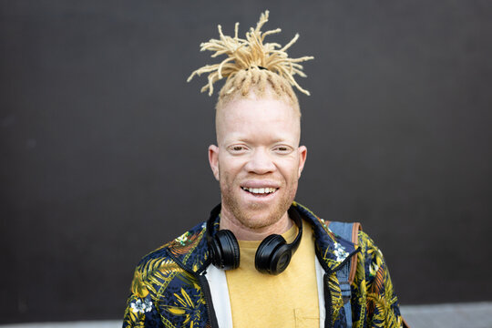 Portrait of albino african american man with dreadlocks looking at camera