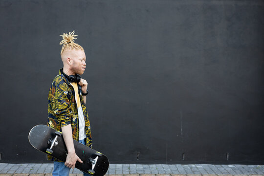 Happy albino african american man with dreadlocks walking holding skateboard