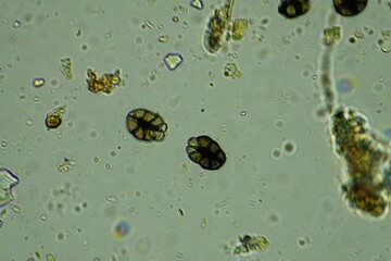 Soil under the microscopy, looking at sand, silt and clay and soil biology, amoebae, fungi, fungal,...
