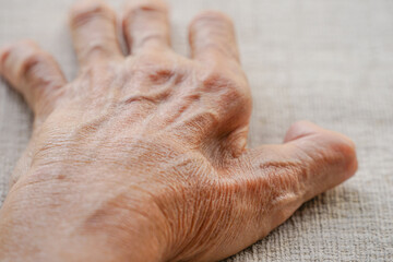 a fossa between index finger and thumb on an old man hand from muscles atrophy, selective focus
