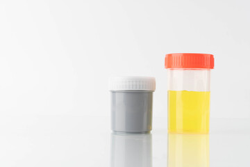 Yellow color urine sample and Stool container specimen bottle for check signs of common conditions or diseases on white background.