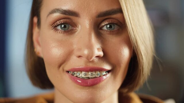 Smiling woman portrait, young female person with braces looking in camera. Model posing close-up of face. Beautiful skin, natural make-up concept.