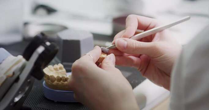 A dental technician makes a denture on a mock-up of the jaw. Female hands working on a denture. Production of dentures and implants.