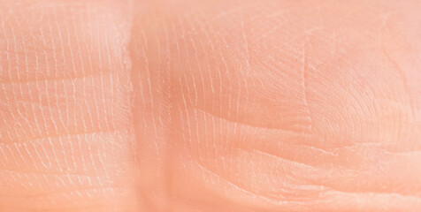 Skin on the back of the finger