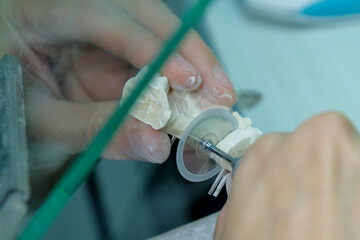 Dental Technician. Work on tooth crown in dental laboratory.