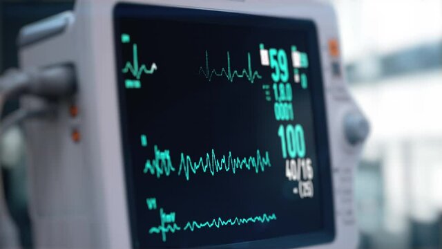 Heart rate monitor in hospital theater. Medical vital signs monitor instrument in a hospital on anesthesia surgery monitor. ECG. Patient heartbeat at the screen
