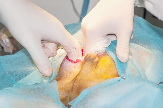 Laparotomy. The process of penetration into the peritoneum. (concept of surgery)