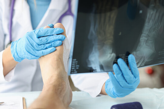 Doctor looking at xray of foot and examining patient leg closeup