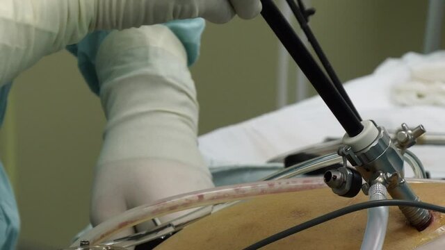 Moscow, Russia - 16 September 2016: Abdominal laparoscopy in operating room close-up. Professional medical equipment in operating room. Work of surgeon doctor.