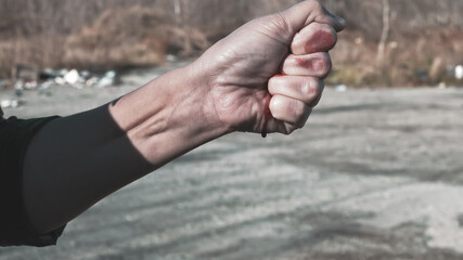 the man 's hand is covered in blood , blood is dripping from the injured man 's hand