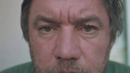 portrait of a homeless alcoholic man with red eyes and a swollen unshaven face close-up looks at the camera