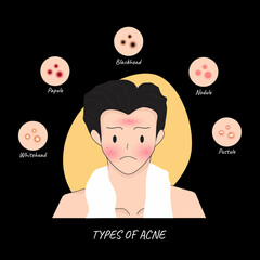 Illustrations Types of acne occur on a man Face