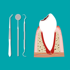 Dental instruments and Tooth. Teeth examination dentistry concept