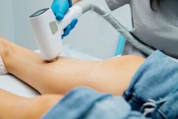 The procedure of laser hair removal of women's legs. Application of sugar paste for the sugaring...