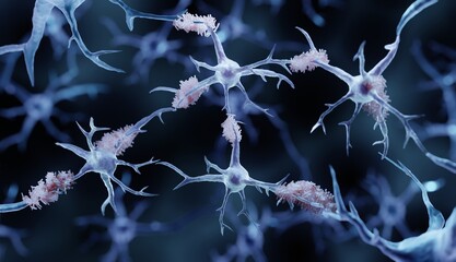 Amyloid plaques in Alzheimer's disease - obrazy, fototapety, plakaty